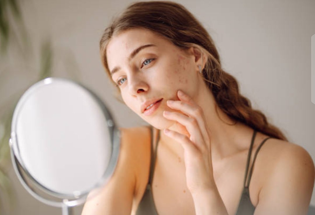 Can Certain Makeup Products Cause Pimples?